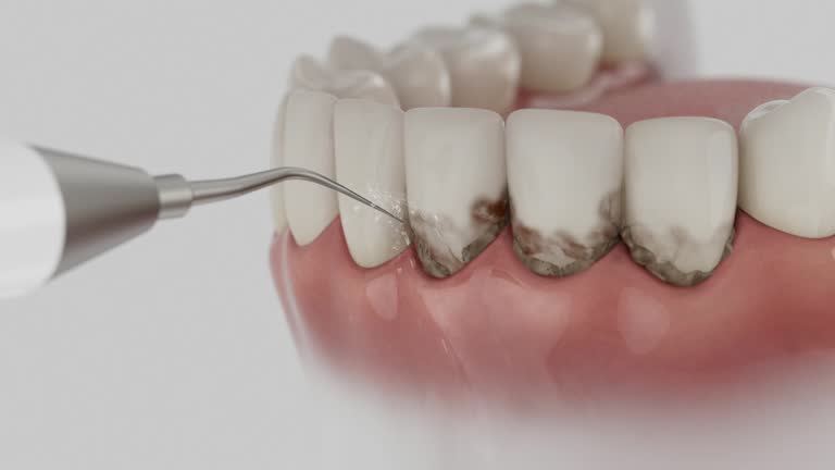 Reliable Dental contractor in Cheney, WA by Dentist Open Now